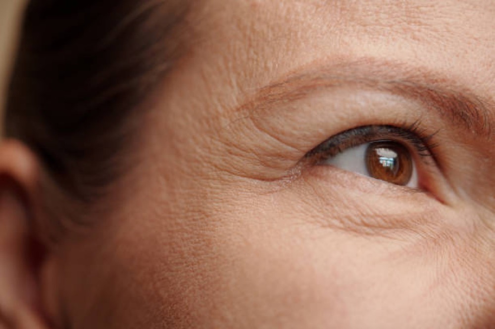 Anti-Wrinkle Injections
